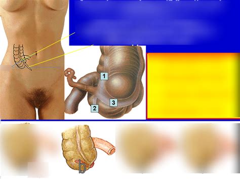 Görsel Appendix Vermiformis Quizlet