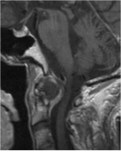 Infection Inflammation Radiology Key