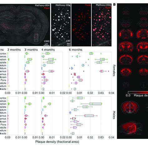 Regional Increases In Beta Amyloid Deposition Via F Av Pet Mri