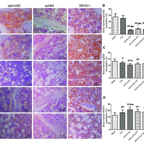 Effects Of Ysjb On Regulation Of The Ephrinb Ephb Nfatc Signaling