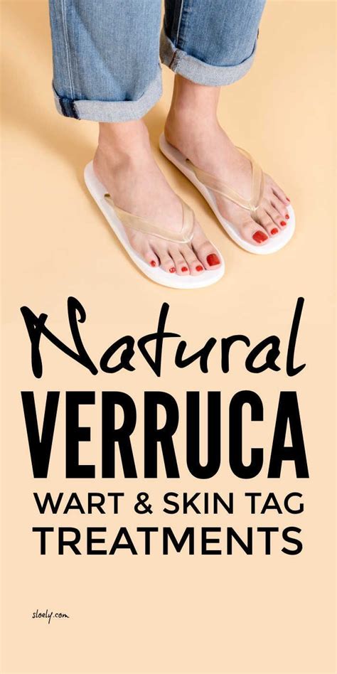 Get Rid Of Verrucas & Warts Naturally | Skin tag treatment, Warts, Natural sleep remedies