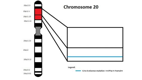 File:Chromosome 20 - JAG1 gene.jpg - Embryology