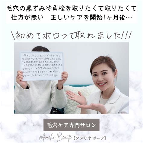 毛穴ケアは何が正解？もっと色々な事をしないといけないと思っていました。 群馬県太田市東京都渋谷区表参道凸凹毛穴・開き毛穴・すり鉢毛穴