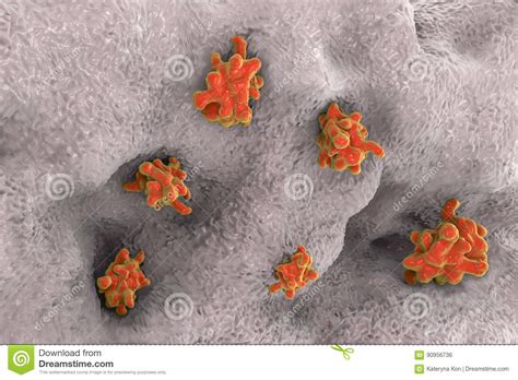 Entamoeba Histolytica Invading Intestine Stock Illustration Illustration Of Ameba Amoeba