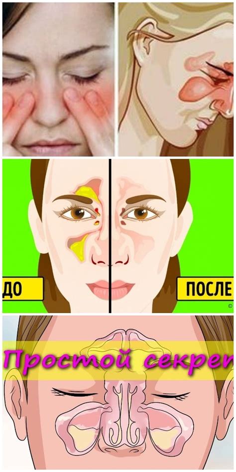6 безотказных способов быстро избавиться от заложенности носа | Food ...