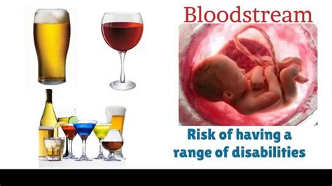 Risks Of Drinking Alcohol While Pregnant Youtube