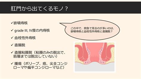 肛門出る _ 脱肛 写真 – Pebble Maths