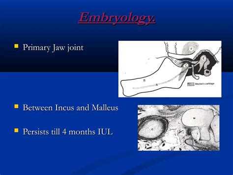 Temporomandibular Joint Development And Anatomy Ppt