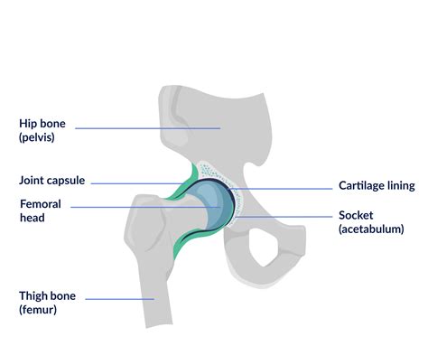 Anatomy, osteoarthritis and total hip replacement surgery – Support
