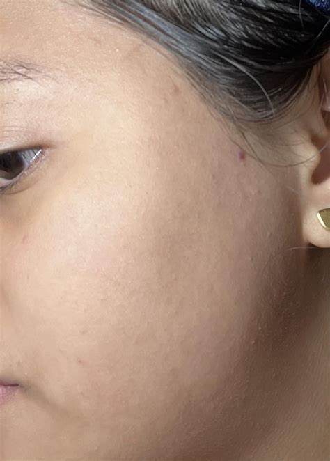 Skincare Advice R Skincareaddicts