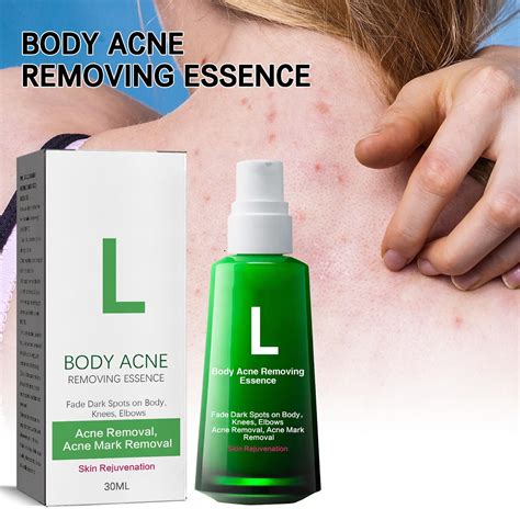 Lightenup Body Acne Serum Lightenup Body Akne Serum For Removing