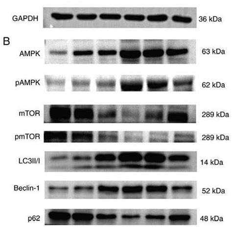 Western Blotting Analysis A Western Blotting Analysis Of Nf κb P65