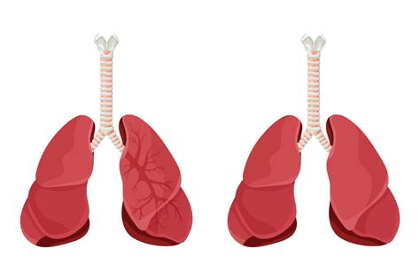 Diagram Of Human Lungs And Trachea Respiratory System Healthy Lungs