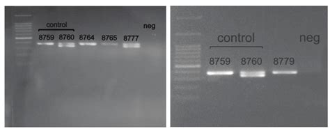 Example Of Pcr Based Sex Determination Parts Of The X Linked Zfx And Download Scientific