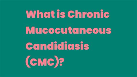 What is Chronic Mucocutaneous Candidiasis (CMC)? - Write A Topic