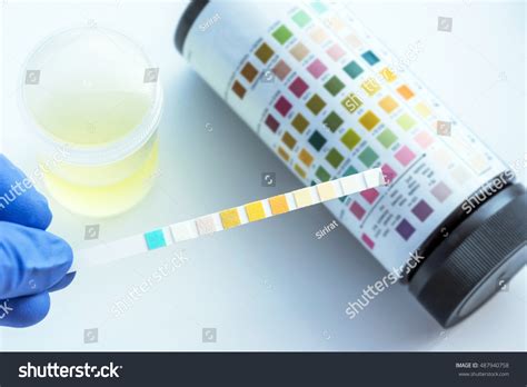 Reagent Strip Urinalysis Routine Urinalysis Checkup Stock Photo