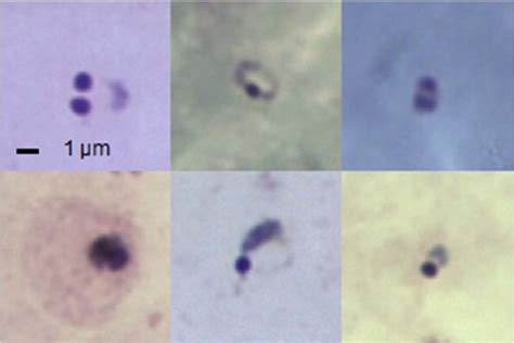 Ring form P. falciparum malaria parasites. | Download Scientific Diagram