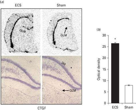 Ecs Induced Expression Of Connective Tissue Growth Factor A In Situ