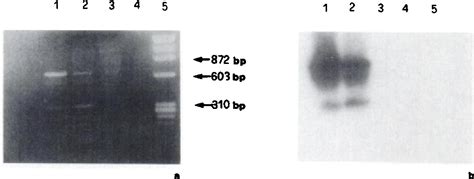 Figure 2 From Estrogen Responsive Human Breast Cancer Cell Lines