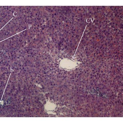 The Liver Histopathological Changes In Obstructive Jaundice Group H E