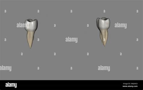 The Mandibular Second Molar Resembles The Mandibular First Permanent