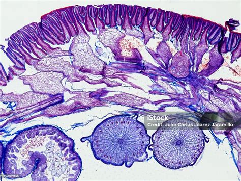 Ascaris Megalocephala Cross Section Under The Microscope Optical Microscope X100 Magnification