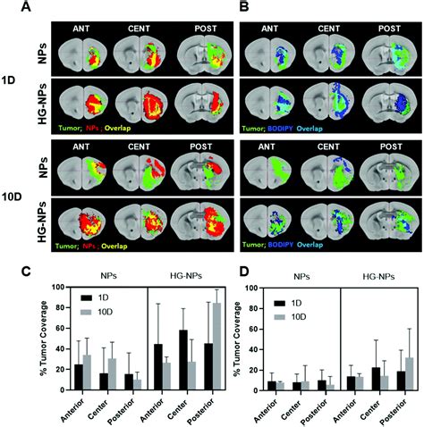 Intratumoral Injection Of Hydrogel Embedded Nanoparticles Enhances