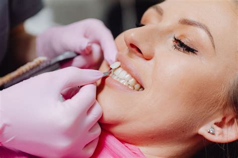 Veneers Strahlend Wei E Z Hne Mit Verblendschalen Zahnvilla Salem