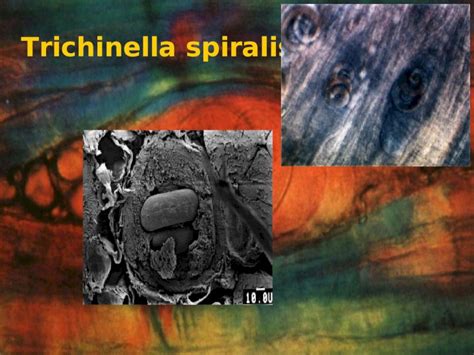 Ppt Trichinella Spiralis Triquinosis Infecci N Parasitaria End Mica