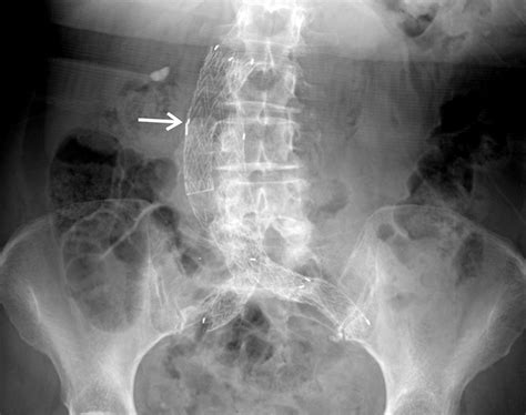 Part Devices Of The Head Neck Spine Chest And Abdomen