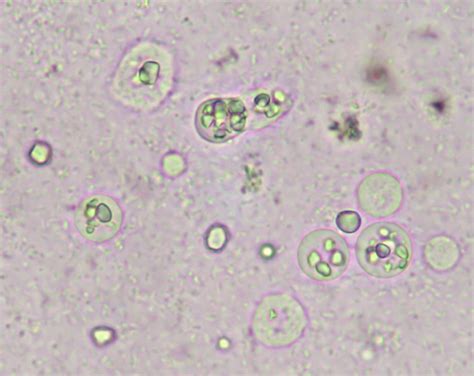 Dientamoeba Fragilis Troph