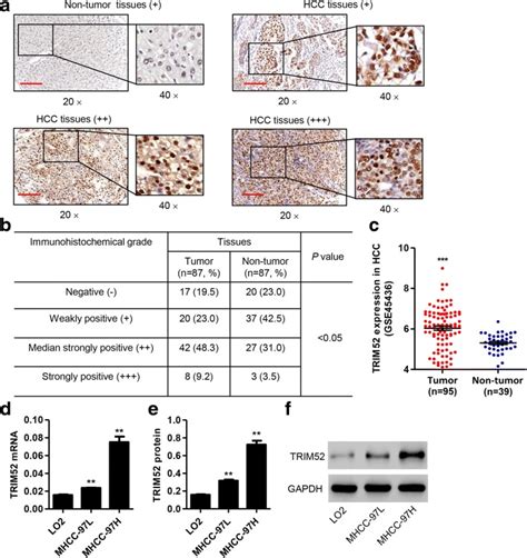 Human Hcc Cell Line Mhcc 97h ATCC Bioz