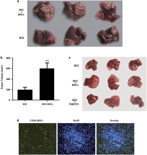 Hepatic Stellate Cells Promote Tumor Progression By Enhancement Of