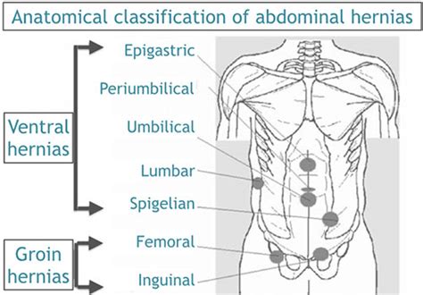 Hernia Clinic Surgeons 101