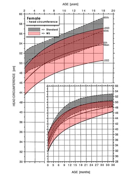 Williams Syndrome Growth Chart