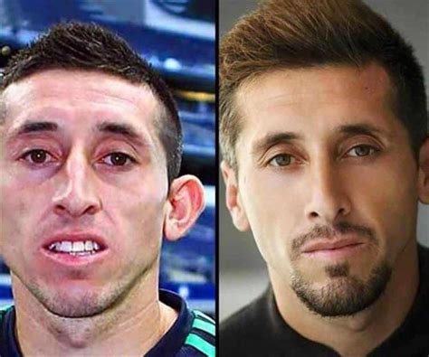 El radical cambio de Héctor Herrera tras cirugía estética