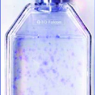Colony-forming unit (CFU) assays and staining. The panels display ... 