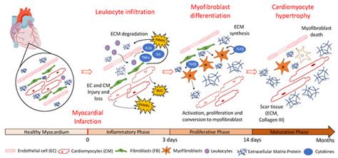 Pharmaceutics Free Full Text Scaffolds And Extracellular Vesicles