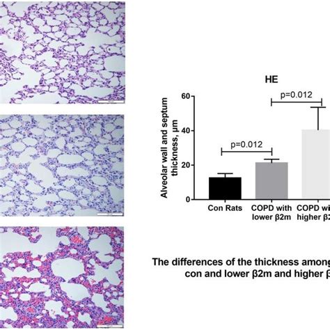 HE Staining Of Lung Tissue From Rats A C Representative Image Of HE