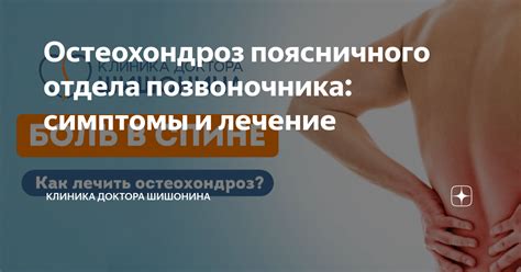 Остеохондроз поясничного отдела позвоночника: симптомы и лечение ...