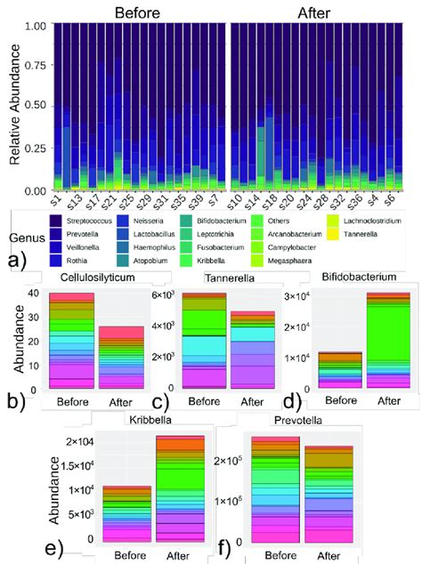 Changes In Salivary Microbiome Before And After Anticancer Treatment