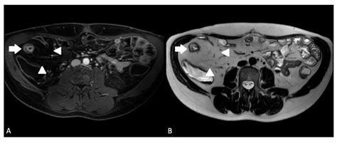 Diagnostics Free Full Text Replacing Endoscopy With Magnetic