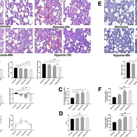 Expression Of VEGF Notch Pathway Related Proteins And CD31 In Rat Lung