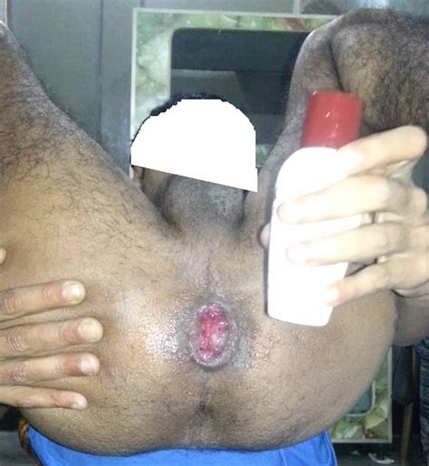 Indian Gay With Fat Ass Masturbated Using Bottle Indian Gay Site