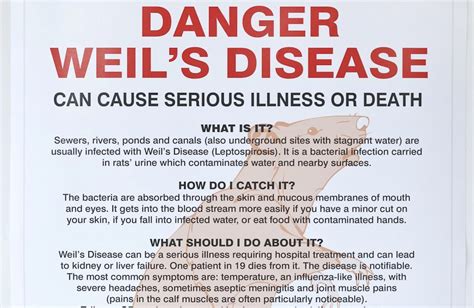 Ulster Hospital Icu Charity Walk Weils Disease Some Facts