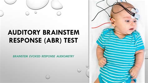 Auditory Brainstem Response ABR Test Brainstem Evoked Response