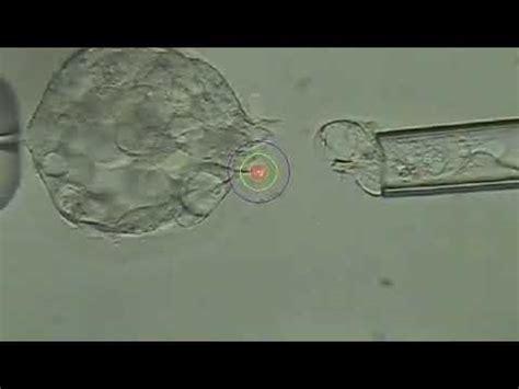 Day 5 Trophectoderm Biopsy by Goral Gandhi - YouTube 