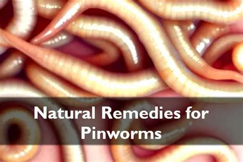 How To Get Rid Of Pinworms Overnight Naturally Does It Work