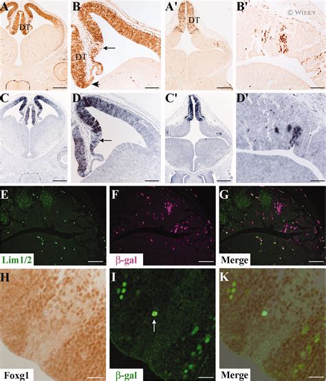 Beta Galactosidase Antibody A