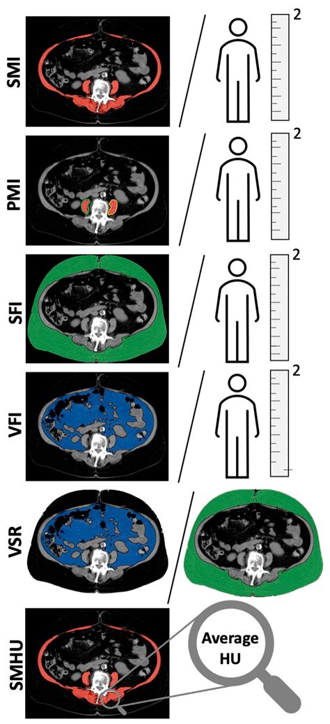 Illustration Of Different Body Composition Measurements At The Height